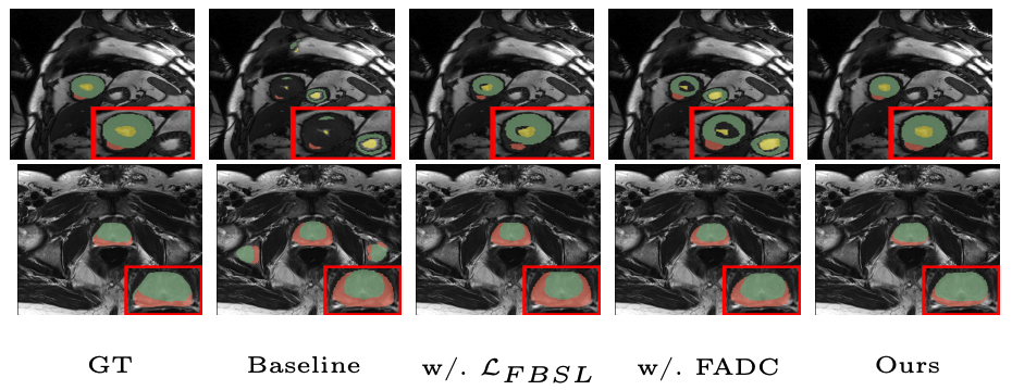 EFFDNet Ablation Study Results